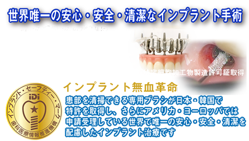 大阪高槻市にある歯医者赤木歯科インプラント治療