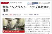 大阪高槻市にある歯医者インプラント専門医の赤木歯科のよくある質問